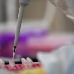 Un proyecto de investigación de la Universidad Miguel Hernández (UMH) de Elche pretende hallar e identificar compuestos bioactivos con potencial terapéutico en las secreciones mucosas de la piel de los peces para tratar infecciones y procesos cancerosos
