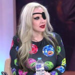 Alaska con el parche en el ojo en Telecinco