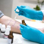 Prueba médica para la detección de alergias